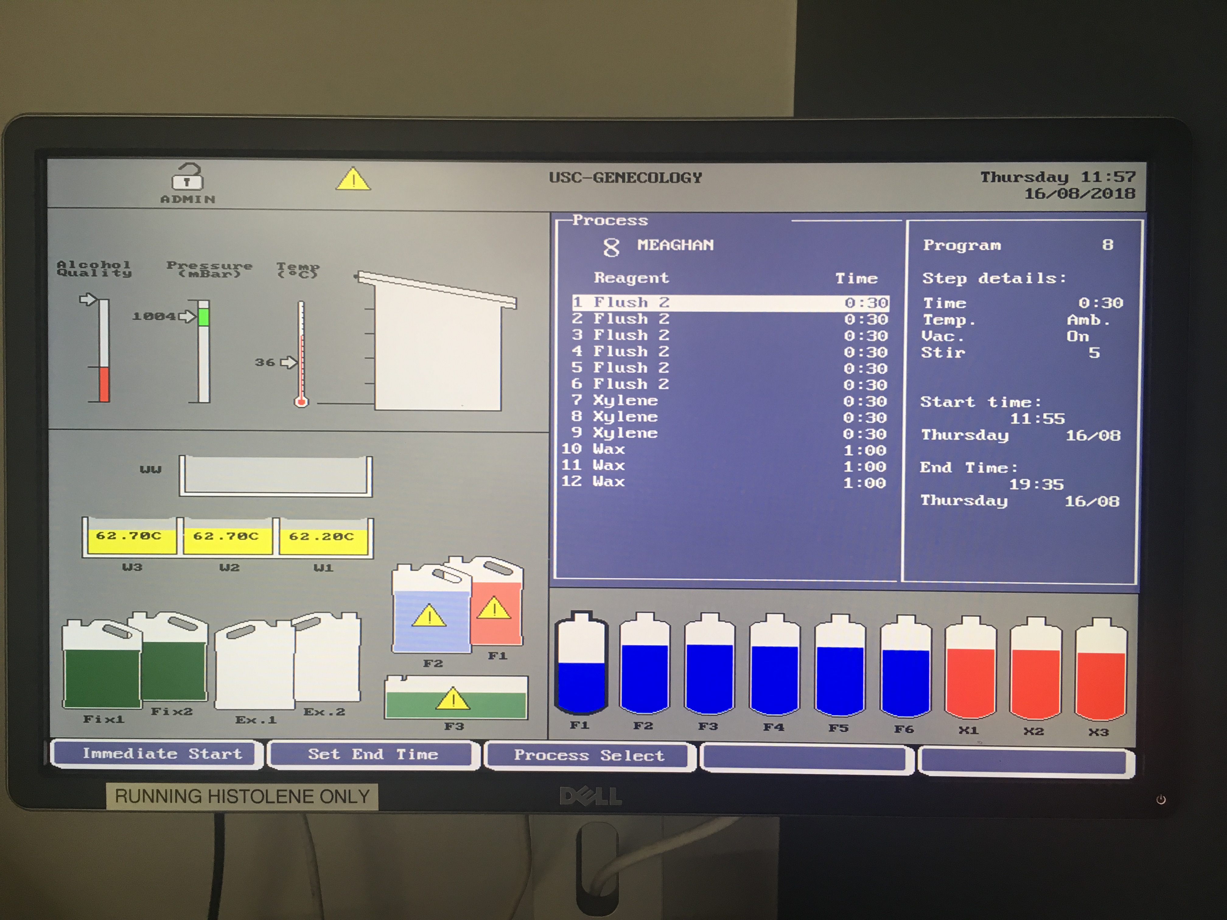 image of tissue processing screen
